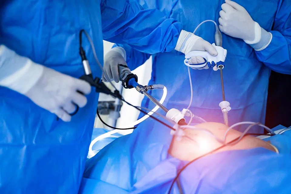 When Is Visceral Surgery Needed? Conditions & Methods